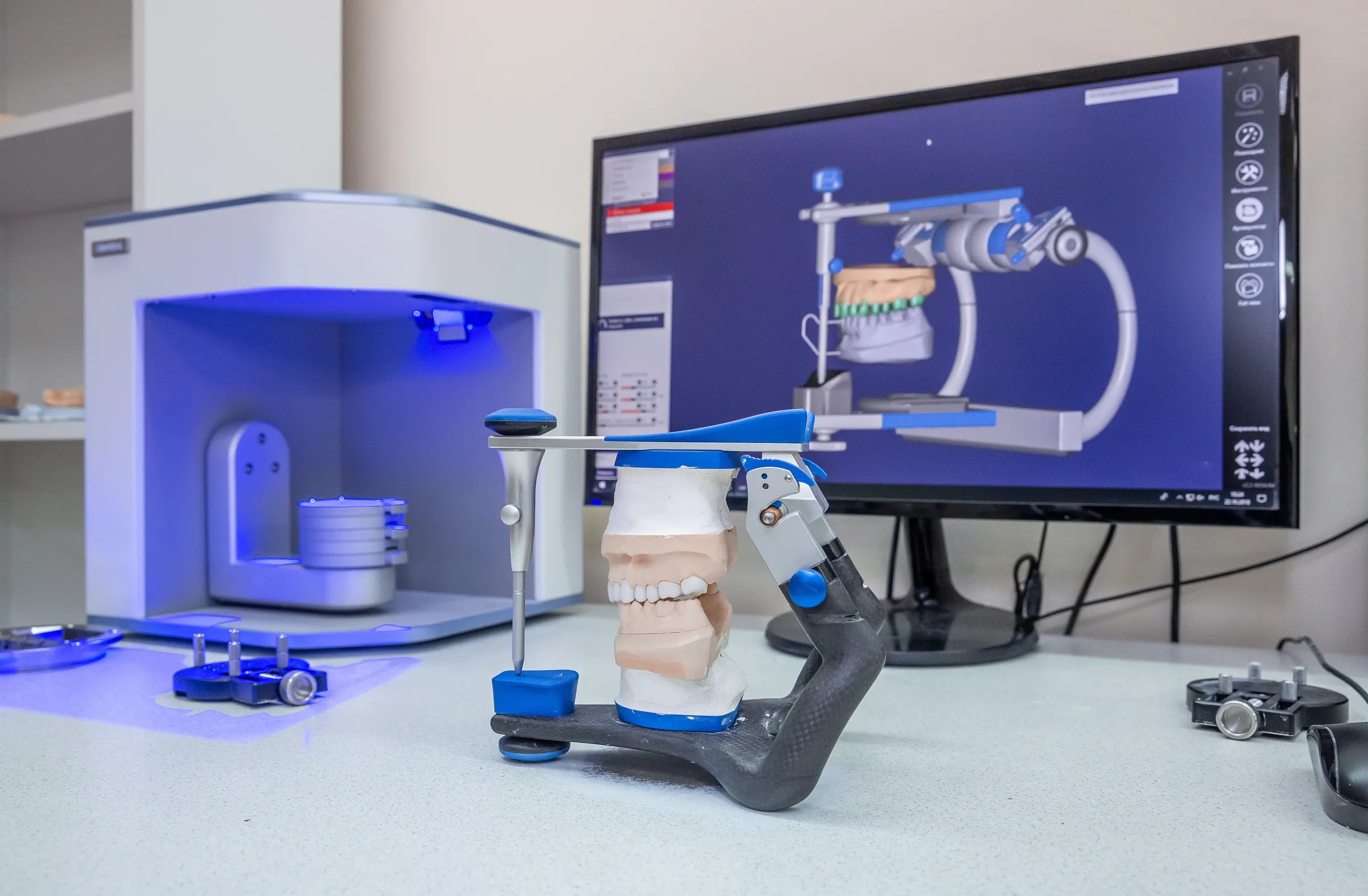 Digital implant planning on a chairside scanner