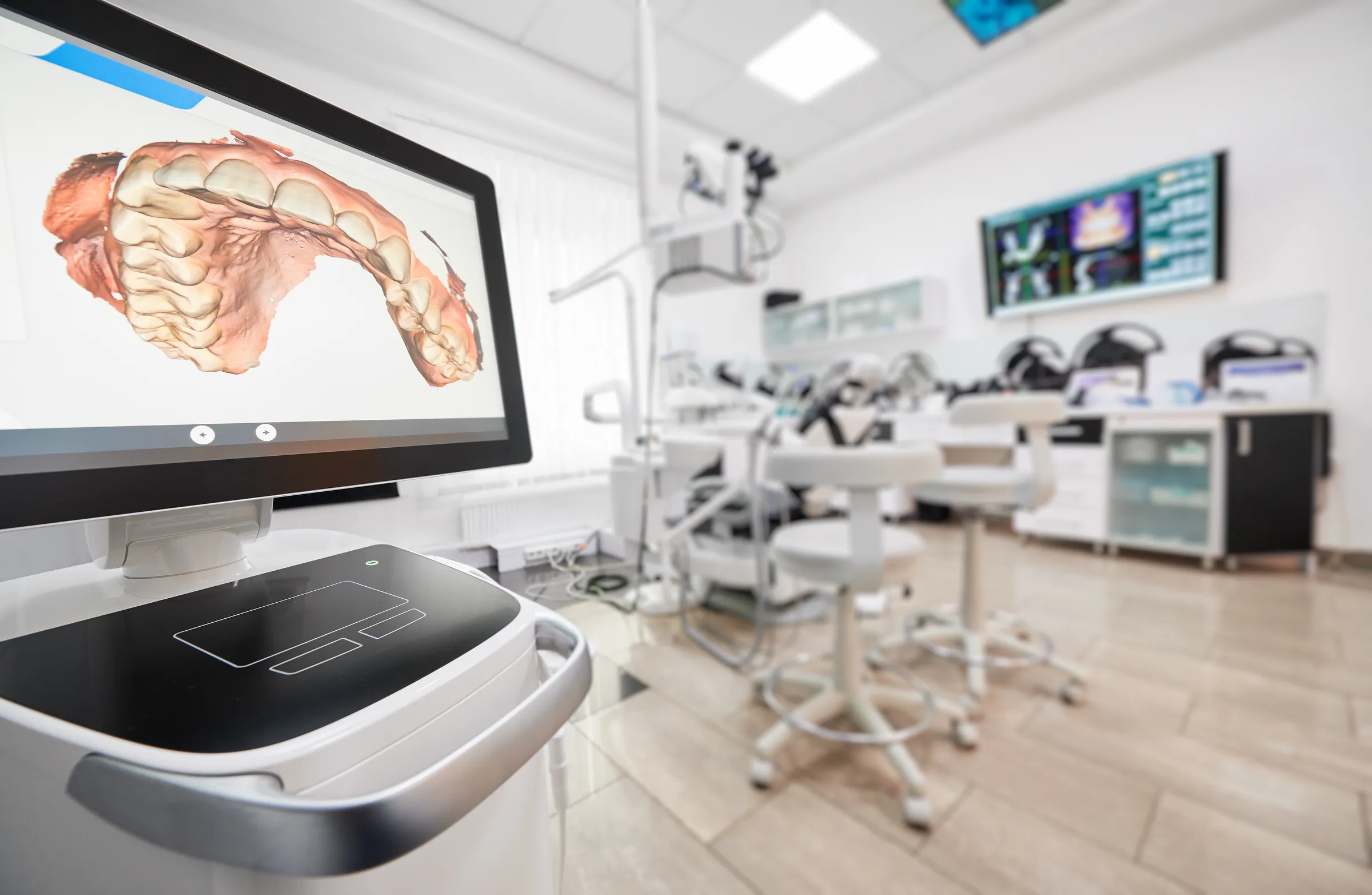 An operatory at Valencia Dental Office with a digital scan on the chairside monitor.