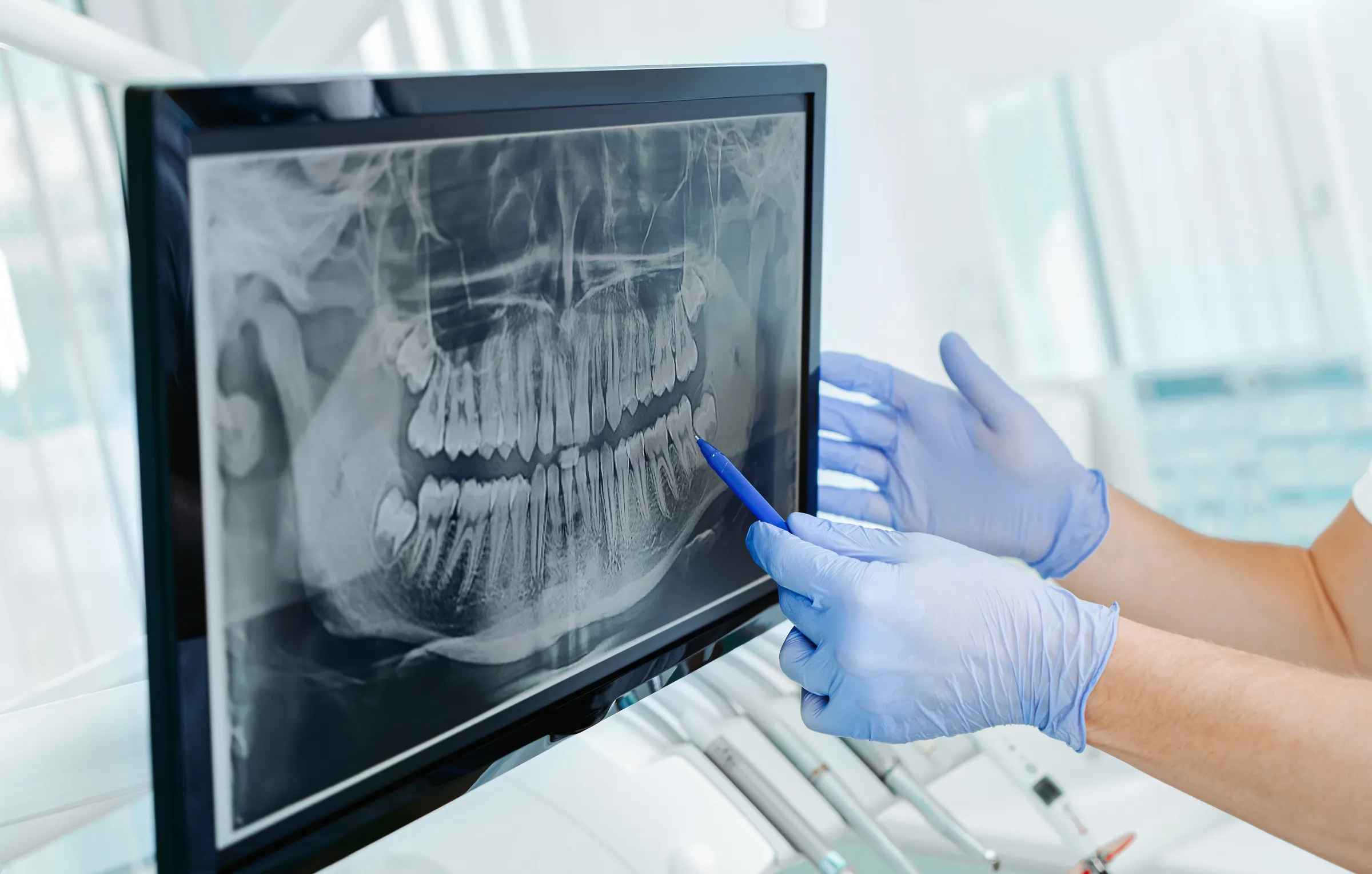 Reviewing a panoramic x-ray while planning implant surgery