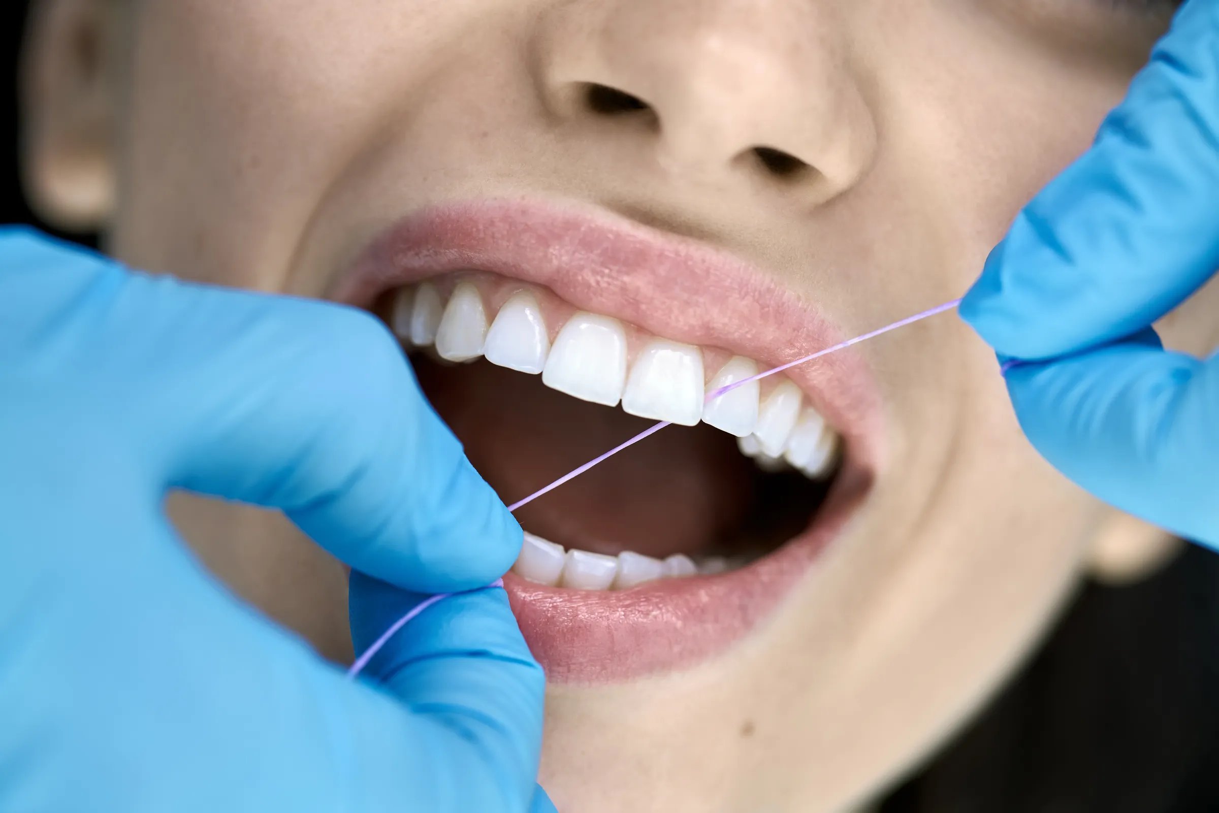 A patient receiving a professional dental cleaning