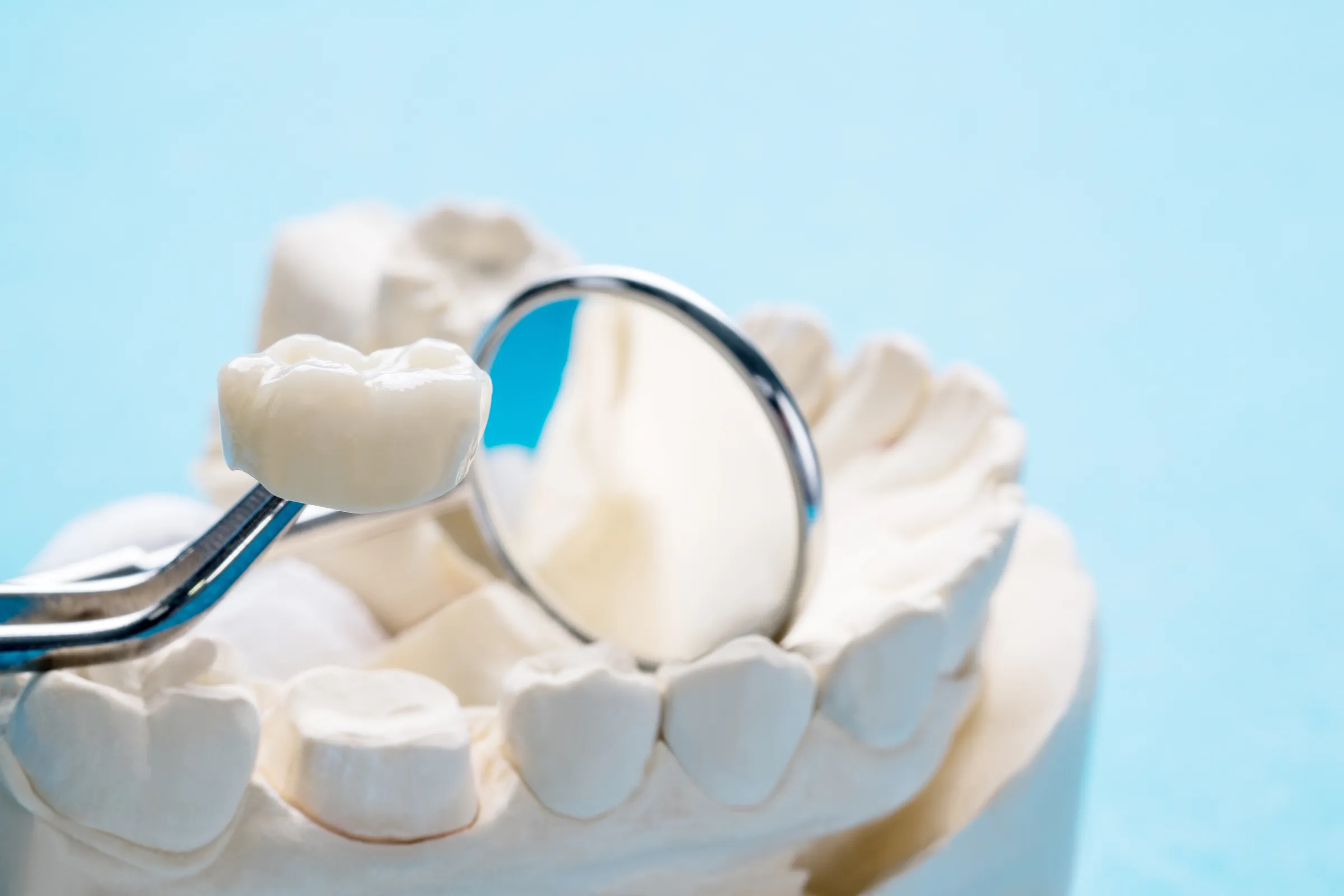 Patient smiling with a natural-looking dental crown