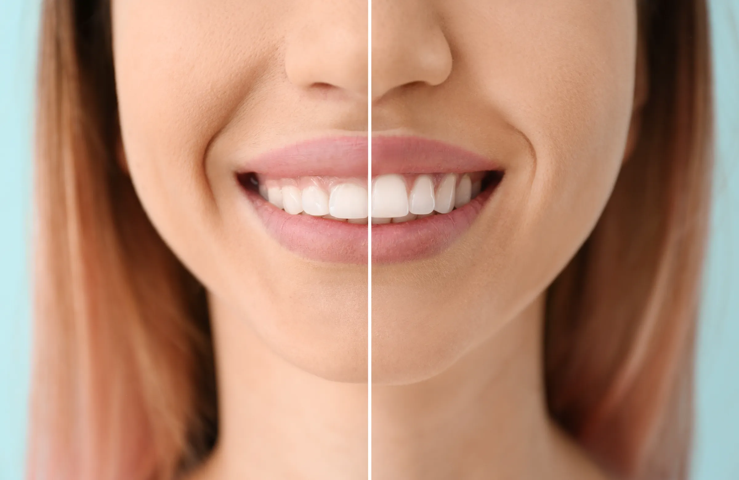 Dentist examining a tooth for crown lengthening