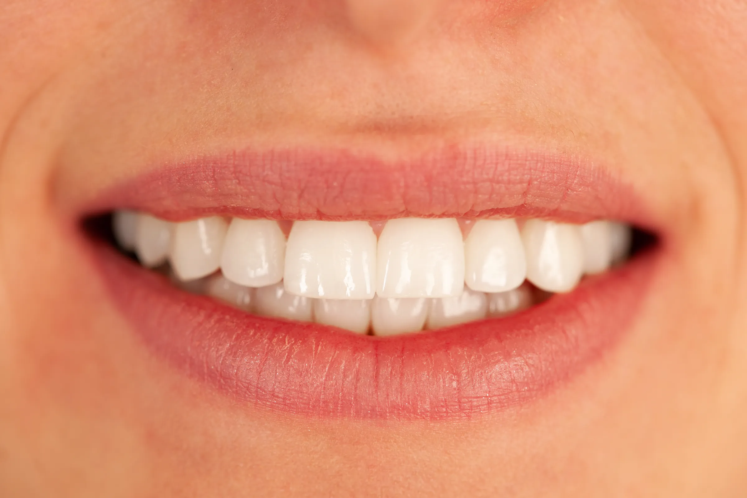 Dentist polishing the edge of a front tooth