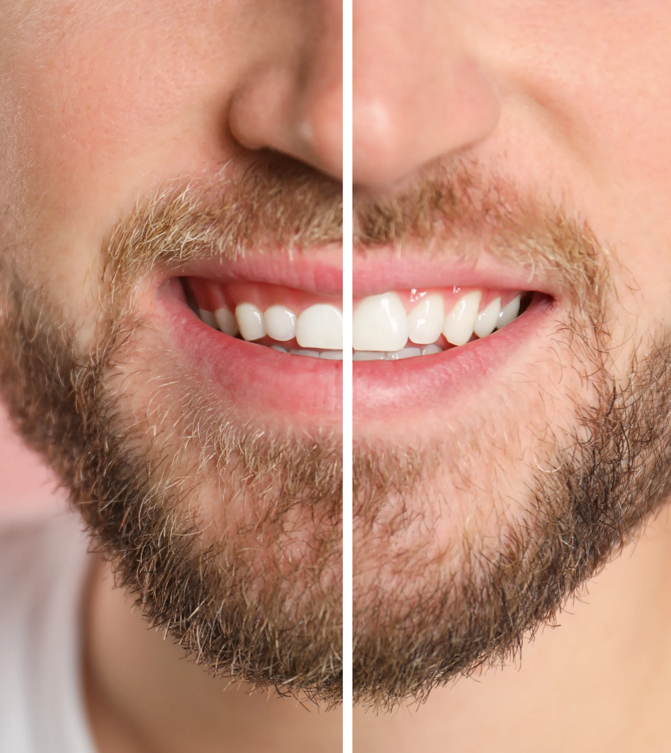 Dentist examining a patient's gumline