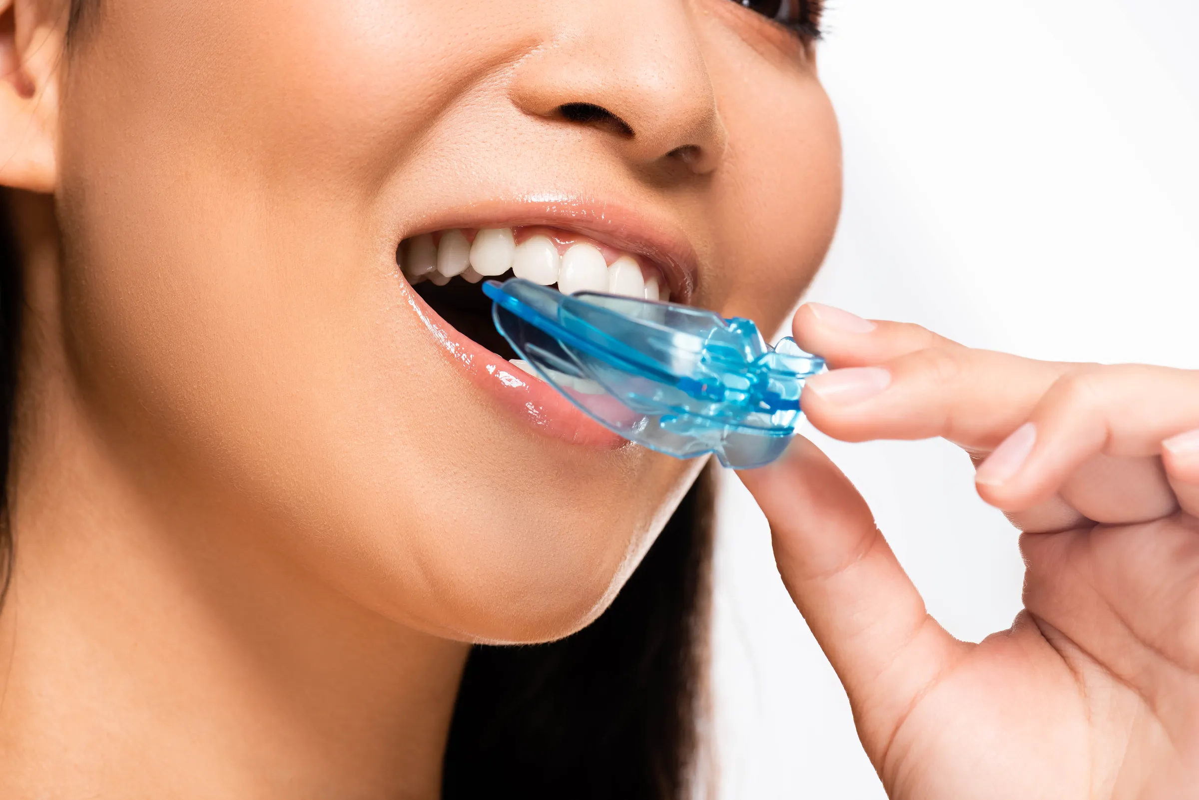 Dentist fitting a custom mouth guard