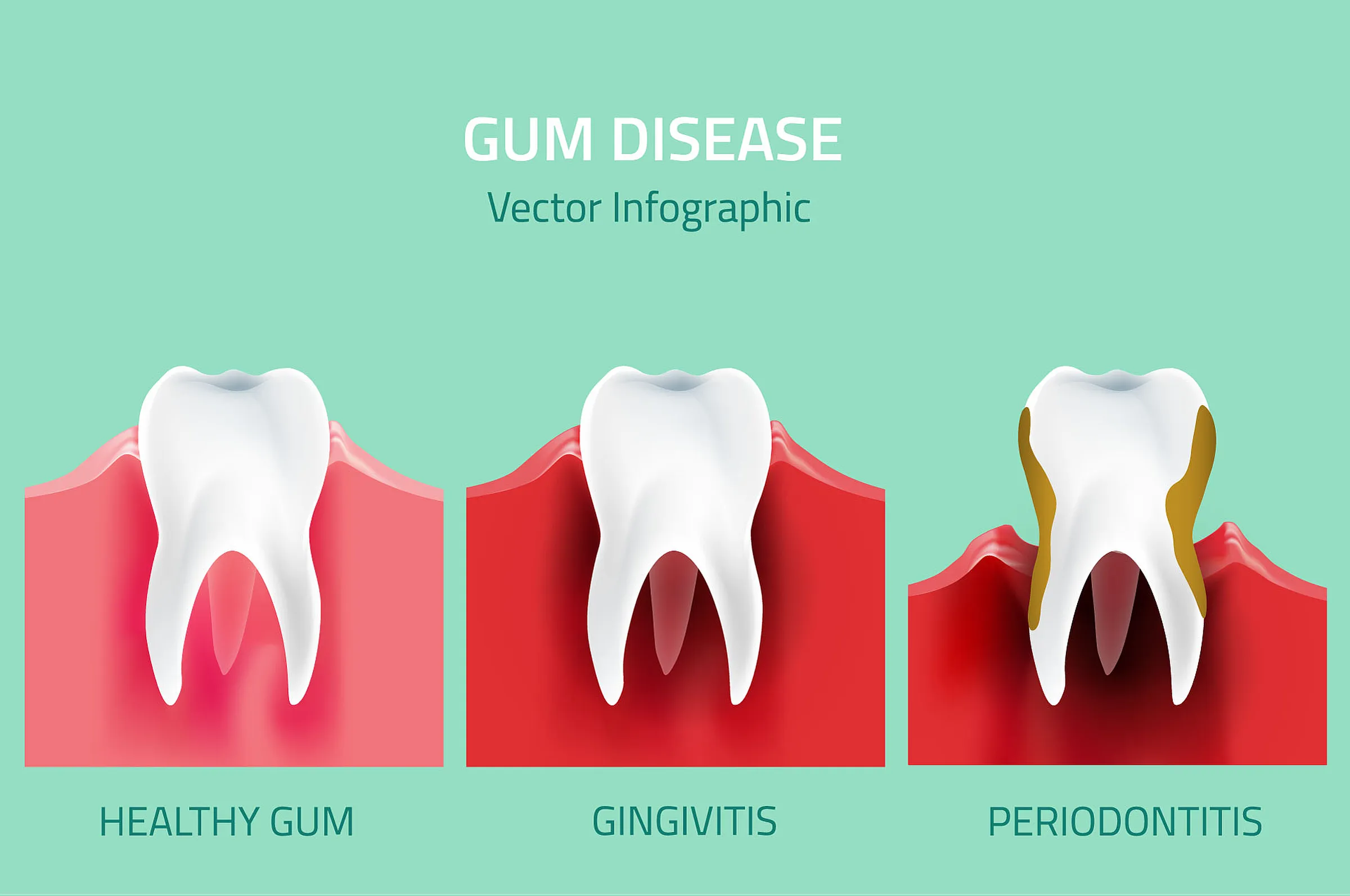 Patient at a follow-up visit after periodontal surgery
