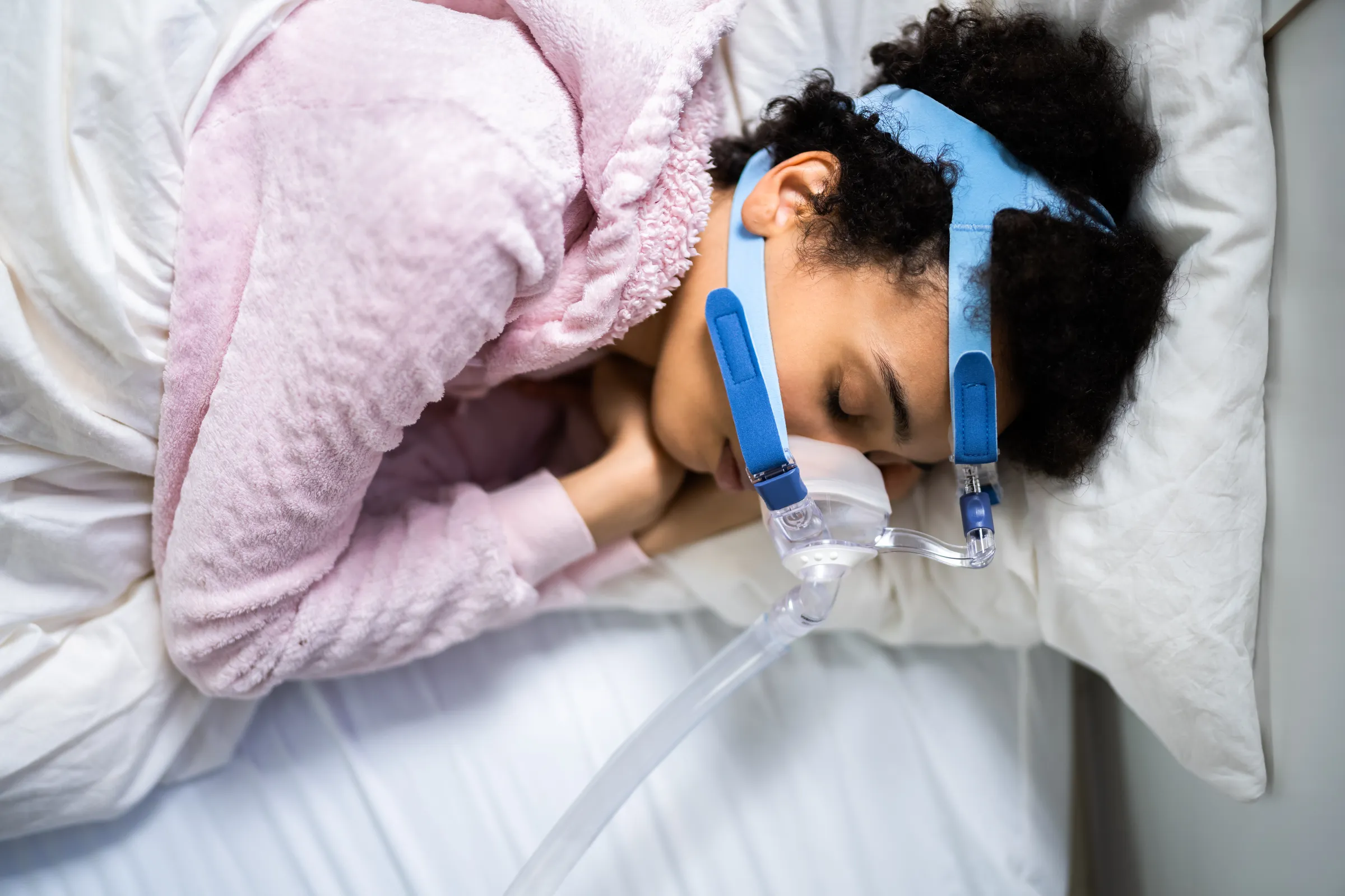 Patient sleeping comfortably with an oral appliance