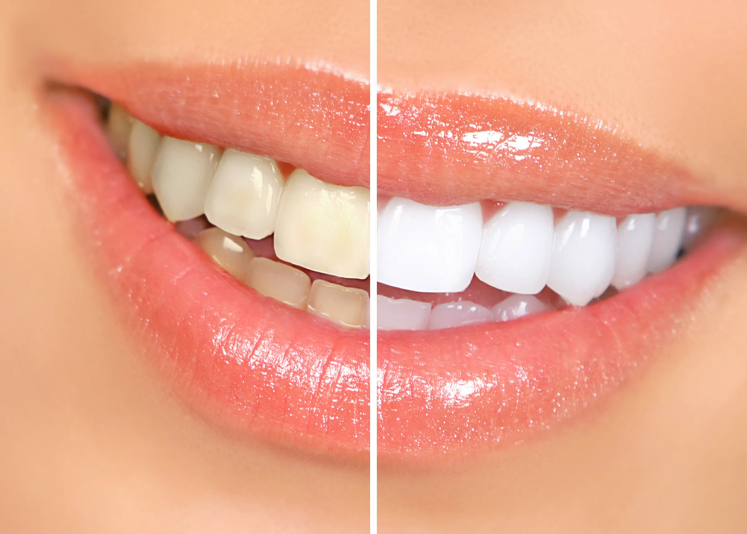 Dentist and patient reviewing smile design options together