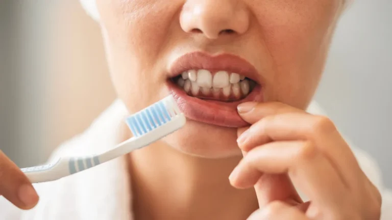 Gingivectomy