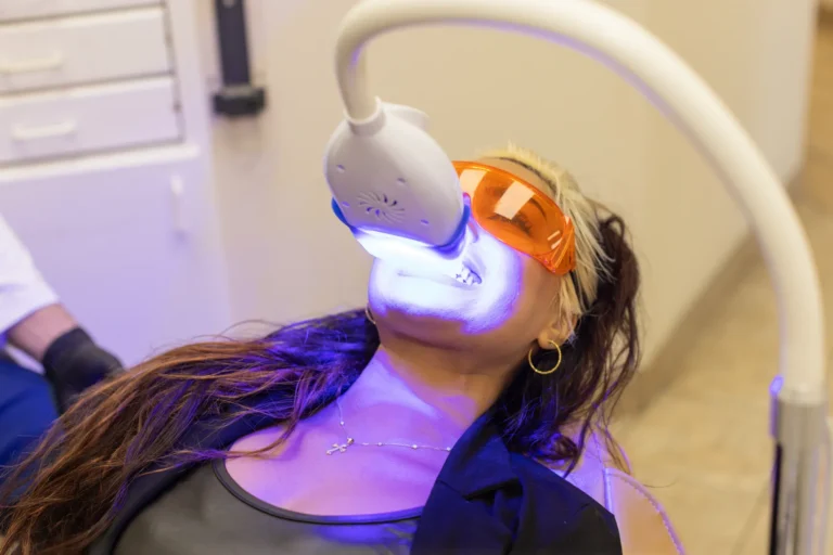 Teeth Whitening