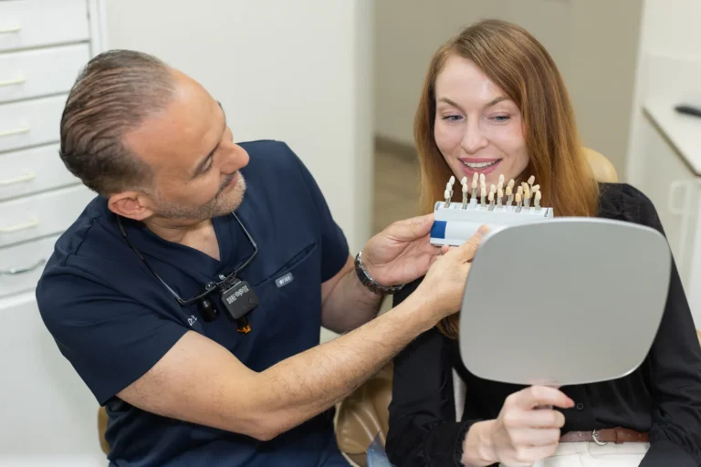 Veneers