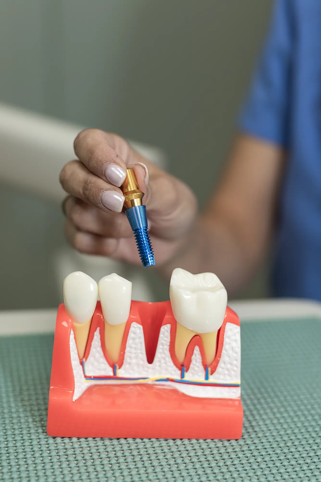 Dentist explaining a dental implant model to a patient