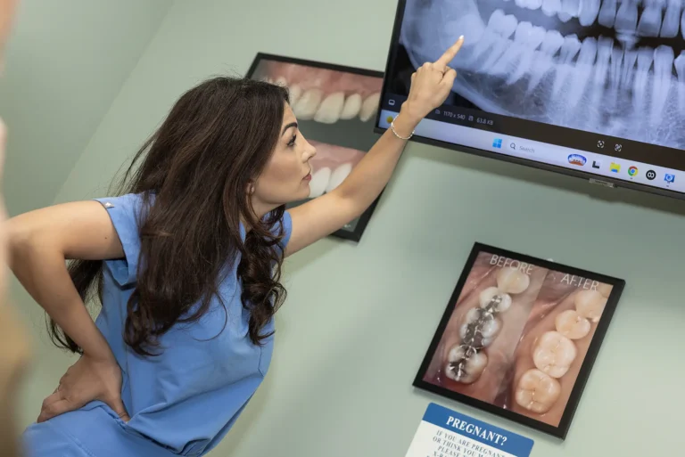 Gingivectomy