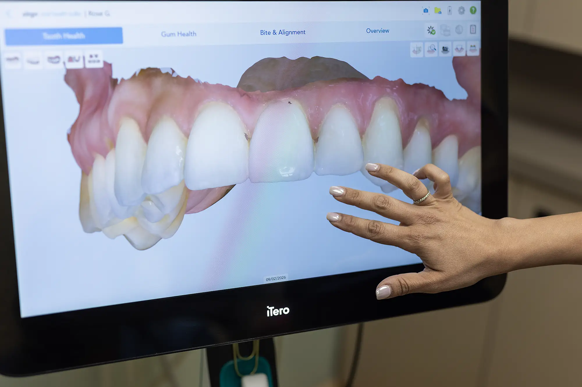 Patient and hygienist talking after a dental exam