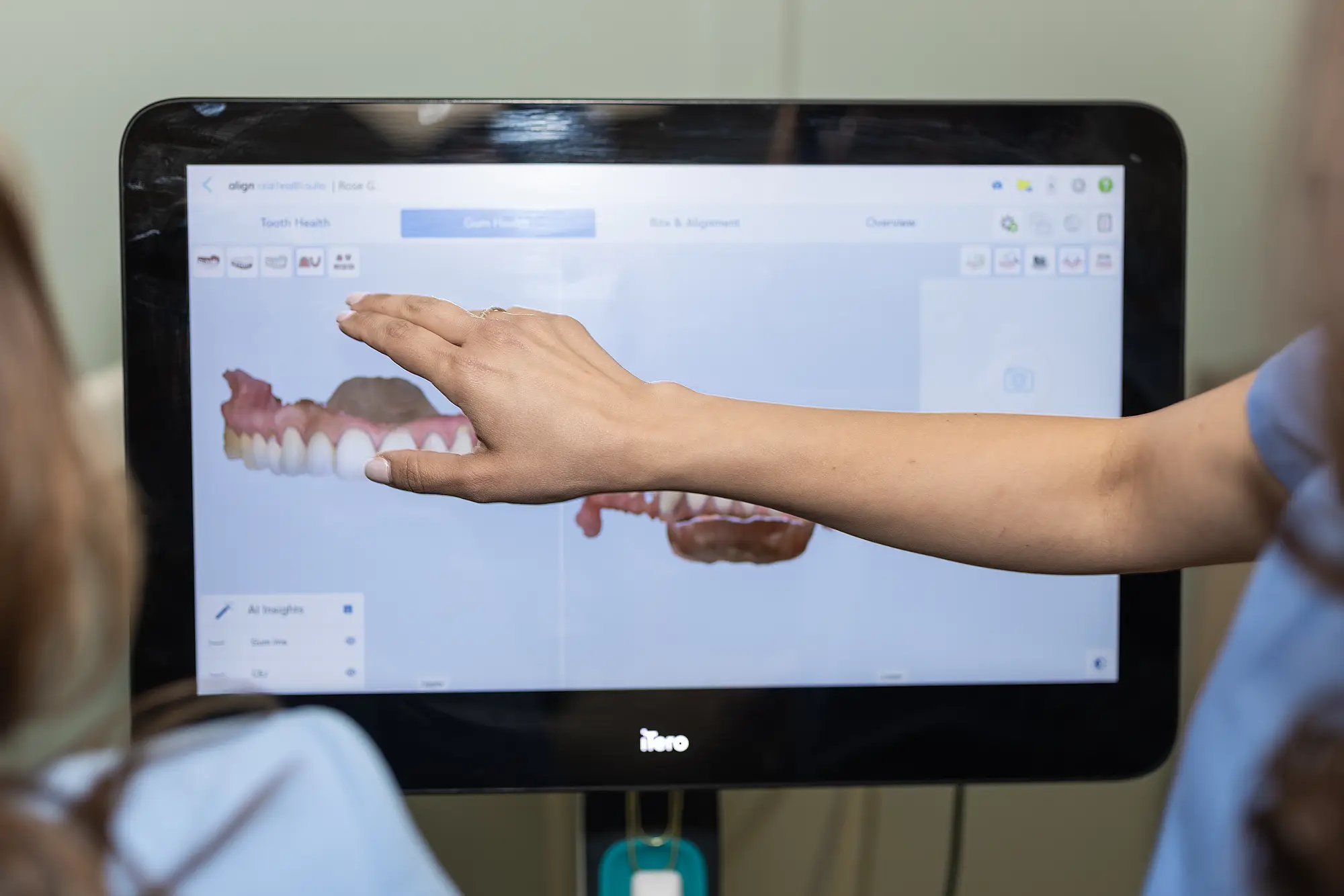 Dentist reviewing the patient teeth